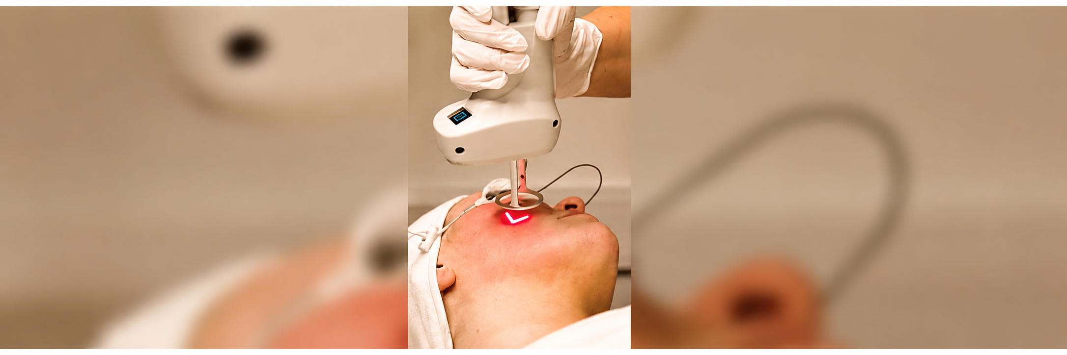 Woman with eye shields receiving laser treatment on her forehead.
